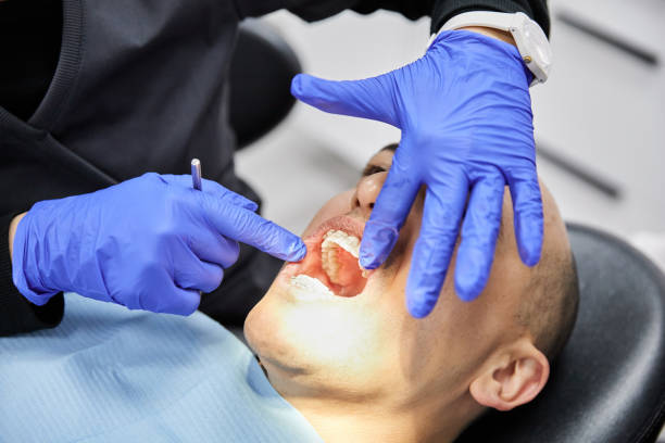 Best Emergency Wisdom Tooth Extraction in Niagara, WI